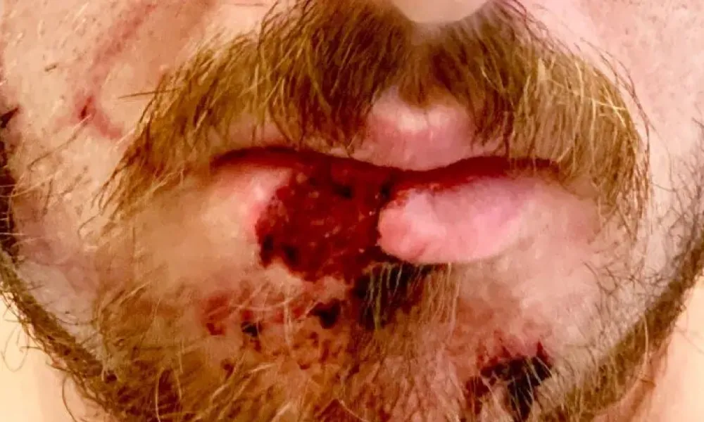 Clinical photo from Tyler's facial trauma repair case